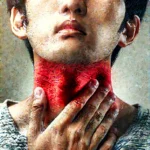 목감기 통증
